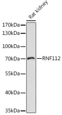 Western Blot: ZNF179 Antibody [NBP2-93335] - Western blot analysis of extracts of Rat kidney, using ZNF179 antibody (NBP2-93335) at 1:1000 dilution. Secondary antibody: HRP Goat Anti-Rabbit IgG (H+L) at 1:10000 dilution. Lysates/proteins: 25ug per lane. Blocking buffer: 3% nonfat dry milk in TBST. Detection: ECL Basic Kit. Exposure time: 60s.